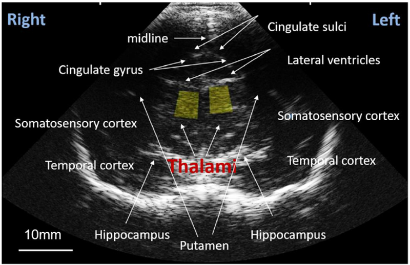 Fig. 3: