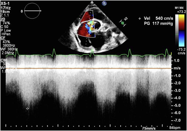 Figure 2