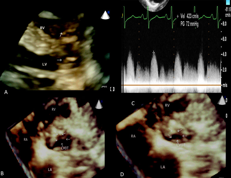 Fig. 2