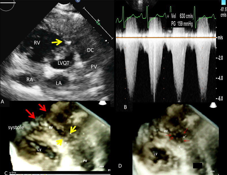 Fig. 1