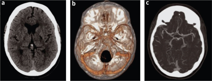 Fig 1.