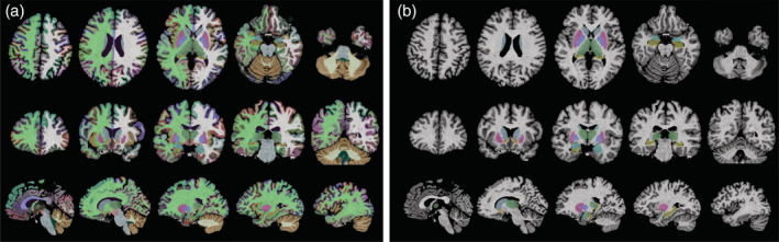 FIGURE 1