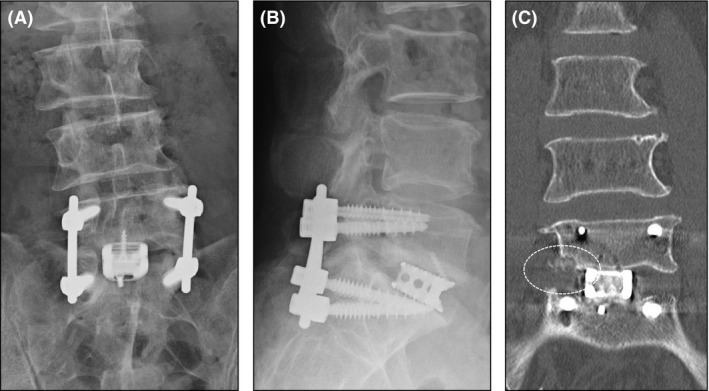 Figure 3