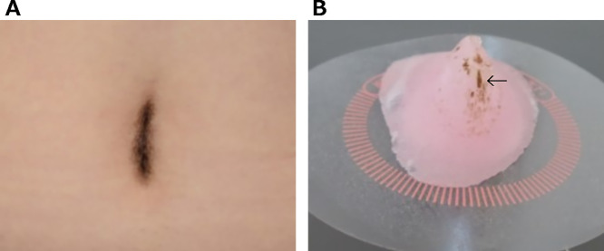 Fig. 1.