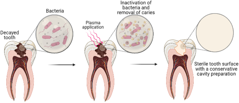 Fig. 4