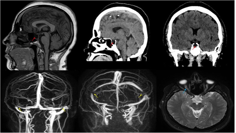 Fig. 1