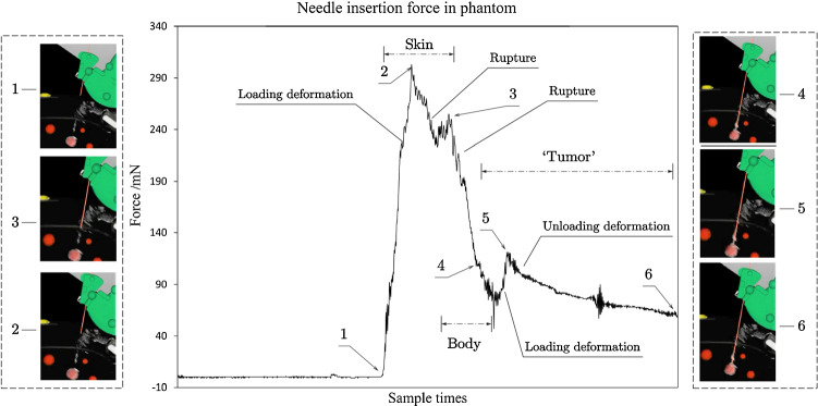 Fig. 15