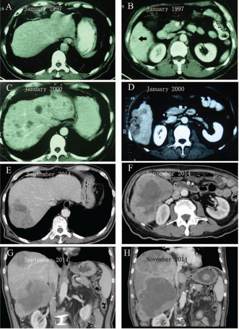 FIGURE 1