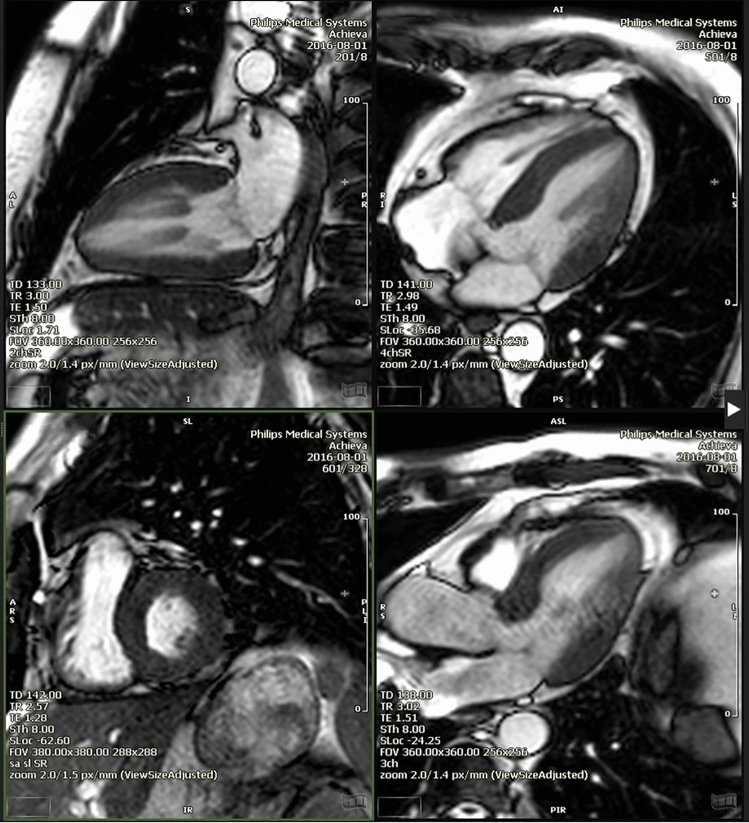 Fig. 2