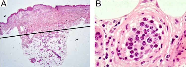 Fig. 1