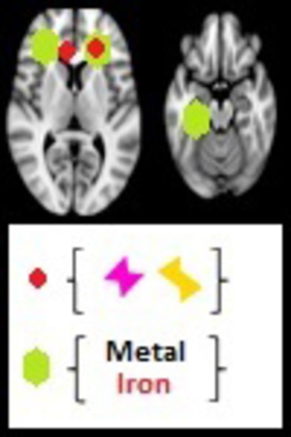 graphic file with name awv048fig1g.jpg