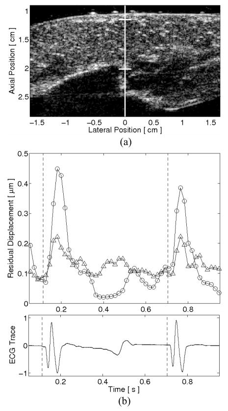 FIG. 5