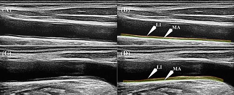 Fig. 3