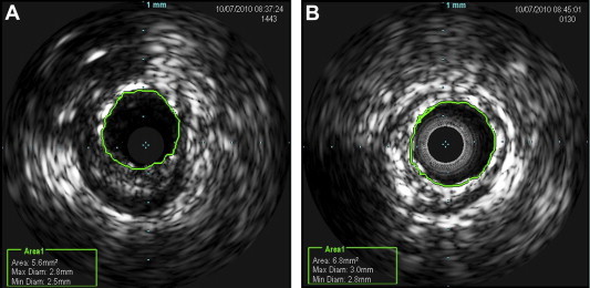 Fig. 2