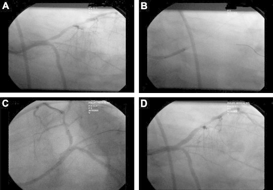 Fig. 1