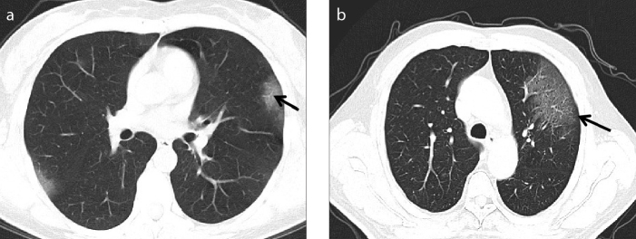 Figure 2. a, b