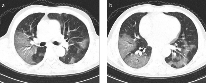 Figure 4. a, b