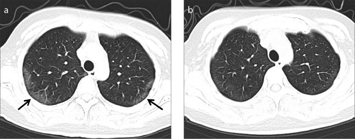 Figure 6. a, b