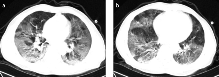 Figure 5. a, b