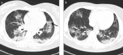 Figure 3. a, b