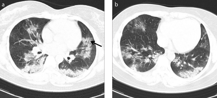 Figure 3. a, b