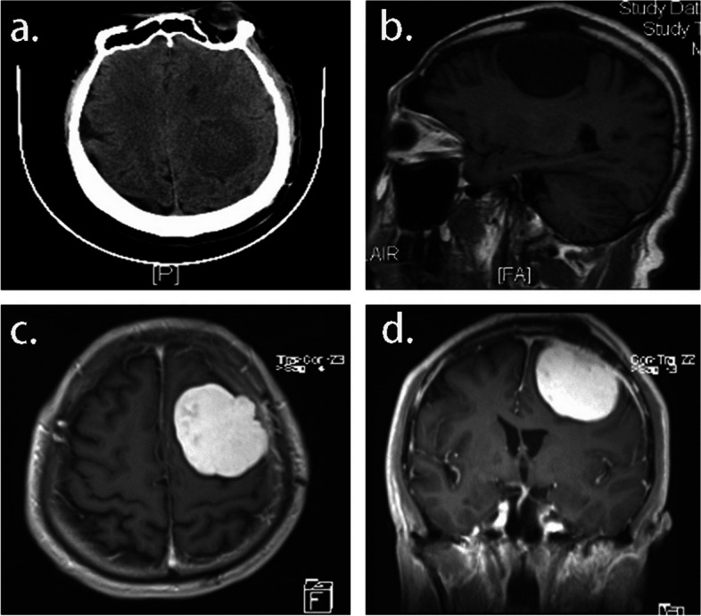 Fig. 1