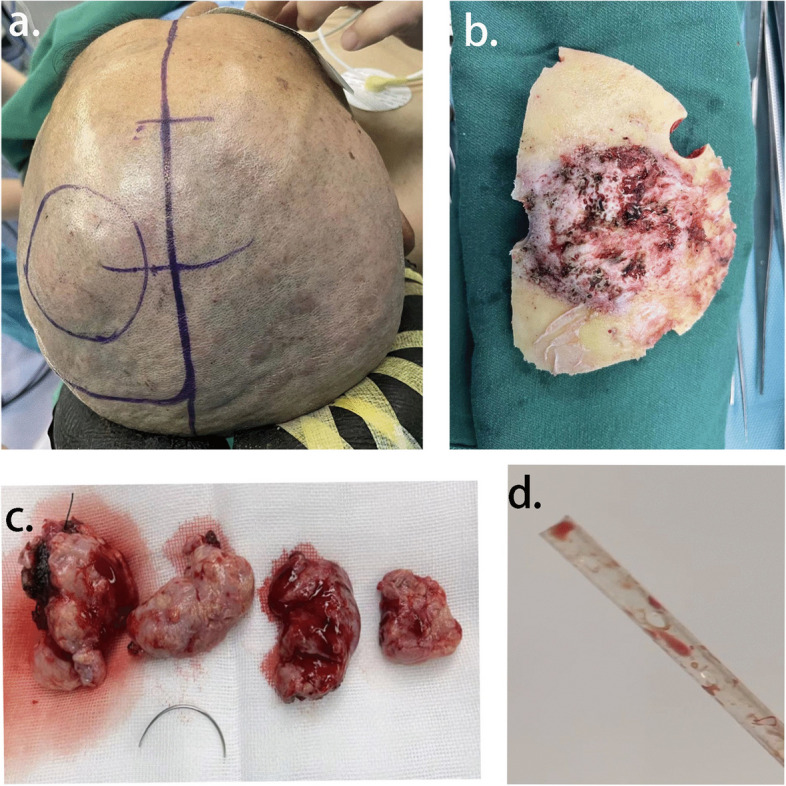 Fig. 2