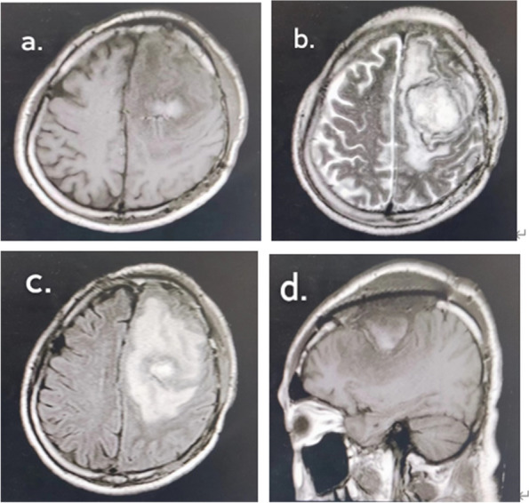 Fig. 5