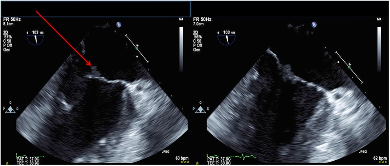 Figure 3