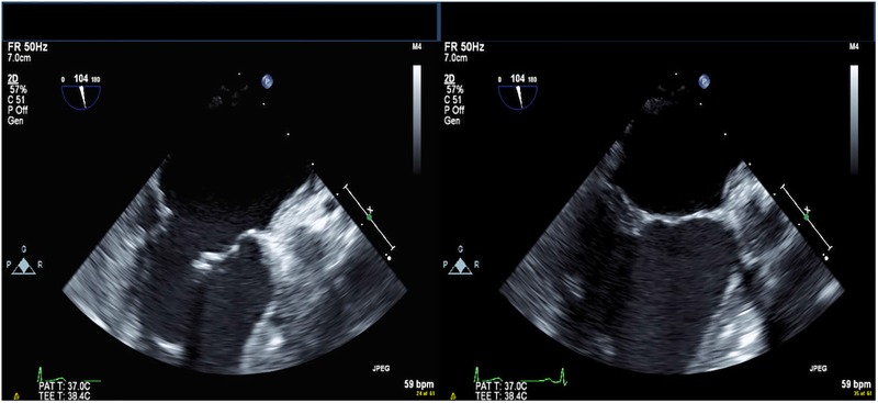 Figure 4