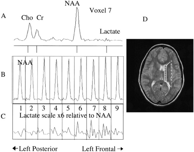 fig 3.