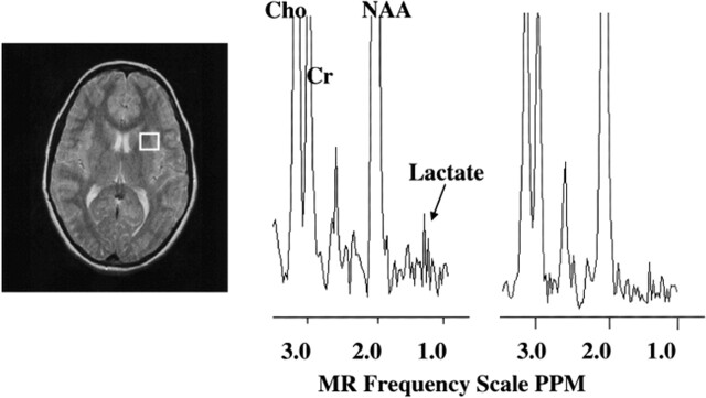 fig 2.