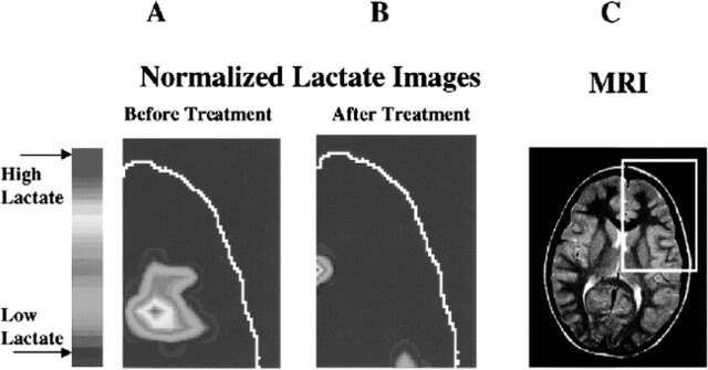 fig 4.