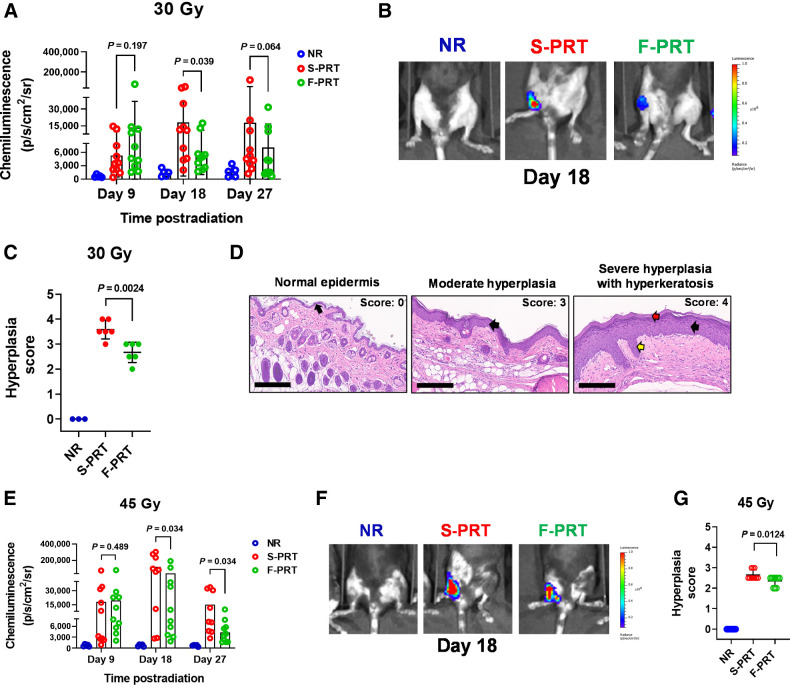 Figure 3. F-PRT reduces inflammation in the irradiated leg compared with S-PRT. A and B, For 30 Gy of proton irradiation, quantification of luminol chemiluminescence as a reporter of inflammation (A), accompanied by representative images of inflammatory signal at Day 18 (NR, n = 5; F-PRT and S-PRT, n = 10; statistical analysis by mixed-effects model; B). C, Blinded histopathologic evaluation of hyperplasia at 27 days post-PRT (NR, n = 3; F-PRT and S-PRT, n = 6; statistical analysis by Welch t test). D, Representative hematoxylin and eosin–stained images of skin hyperplasia. Left, normal epidermal layer (black arrow); middle, moderate chronic damage including a thickened hyperplastic epidermis (black arrow); right, severe chronic damage, including a severely thickened and hyperplastic epidermis (black arrow) with thick layers of orthokeratotic keratin (red arrow) and long rete pegs (yellow arrow). Hematoxylin and eosin, magnification, ×200. Scale bar, 200 μm. E and F, For 45 Gy of proton irradiation, quantification of luminol chemiluminescence (E), accompanied by representative images of inflammatory signal at Day 18 (NR, n = 5; F-PRT and S-PRT, n = 10; statistical analysis by mixed-effects model; F). G, Blinded histopathologic evaluation of hyperplasia at 27 days post-PRT. N = 10 per group with statistical analysis by Welch t test.