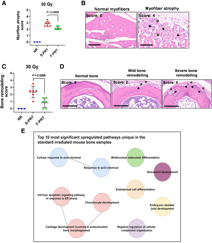 Figure 5. Damage to the muscle and bone by proton RT is ameliorated by F-PRT as compared with S-PRT. A, Blinded evaluation of myofiber atrophy of the gastrocnemius muscle of mice treated by 30 Gy of F-PRT versus S-PRT, at 27 days after RT. Statistical analysis by Welch t test. B, Representative images of hematoxylin and eosin–stained nonirradiated normal myofibers and myofiber atrophy of irradiated tissue. Myofibers of the irradiated tissue show degenerative changes including decreased cross-sectional diameter (i.e., atrophy), vacuolation of the cytoplasm (black arrows), and internalization of nuclei (yellow arrows). Hematoxylin and eosin, magnification, ×400. Scale bar, 60 μm. C, Blinded evaluation of bone remodeling in mice treated by 30 Gy of F-PRT versus S-PRT, at 27 days after PRT. Statistical analysis by Welch t test. D, Representative images of hematioxylin and eosin–stained bone sections. Left, normal (nonirradiated) bone with normal bone marrow; middle, irradiated bone with resorption (black arrows) lined by activated osteoclasts and osteoblasts (yellow arrows); right, multiple large regions of bone resorption (black arrows) with numerous activated osteoclasts and osteoblasts (yellow arrows). Hematoxylin and eosin, magnification, ×200. Scale bar, 200 μm. For A and C, NR, n = 3; F-PRT and S-PRT, n = 6; statistical analysis by Welch t test. Values in A and C represent mean ± SD. E, Gene ontology enrichment analysis of the differentially expressed (upregulated) genes in the S-PRT-treated mouse leg bone; n = 4 per group.