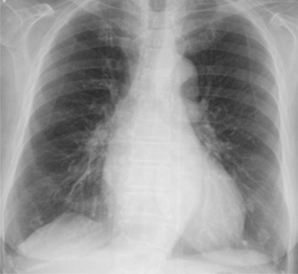 Fig. 1