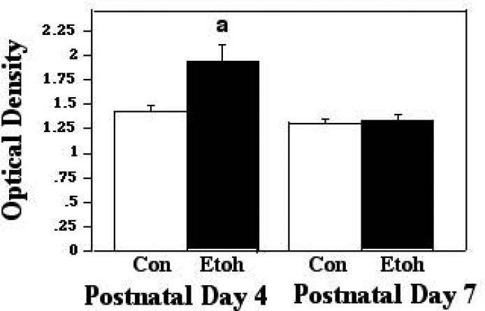 Figure 1B