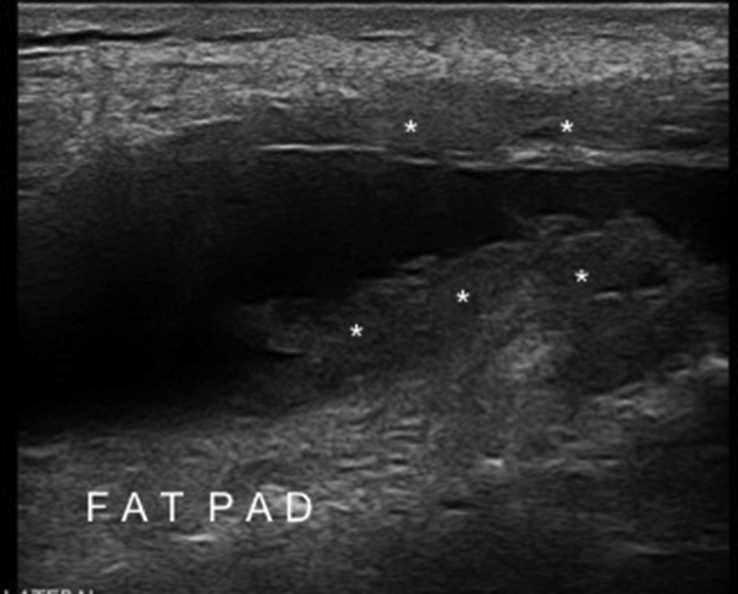 Fig. 11