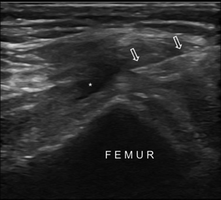 Fig. 13