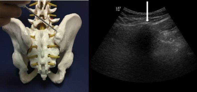 Fig. 3