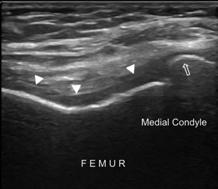 Fig. 10