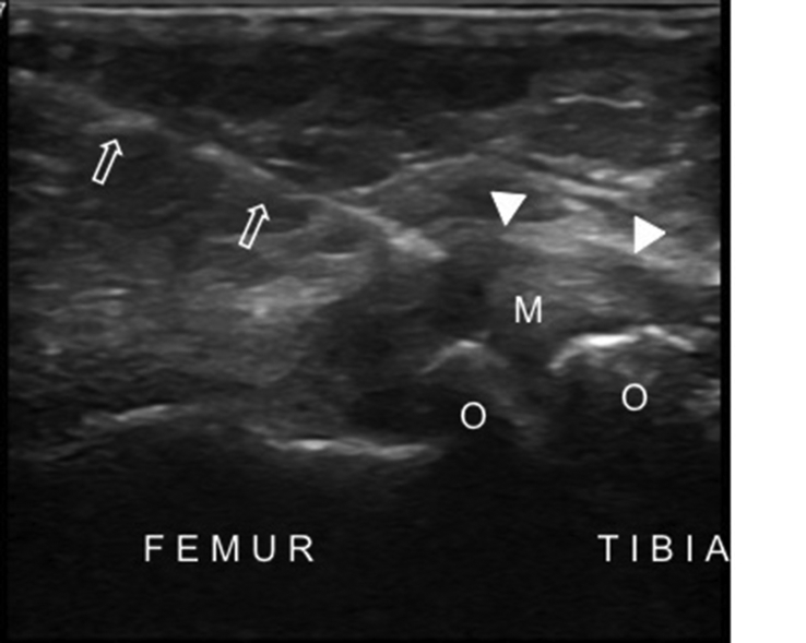 Fig. 14