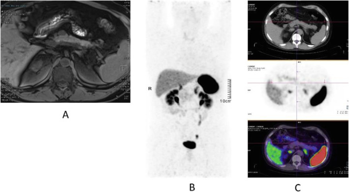 Fig. 49