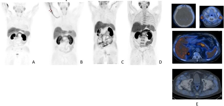 Fig. 19