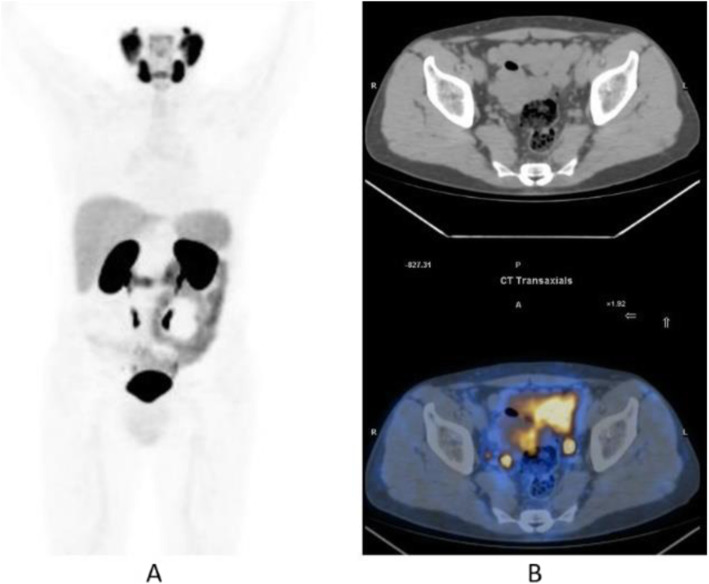 Fig. 31