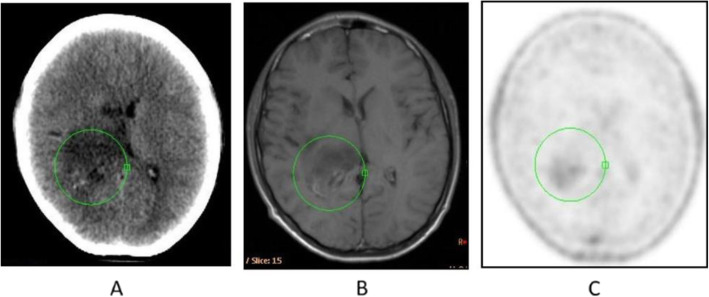 Fig. 9