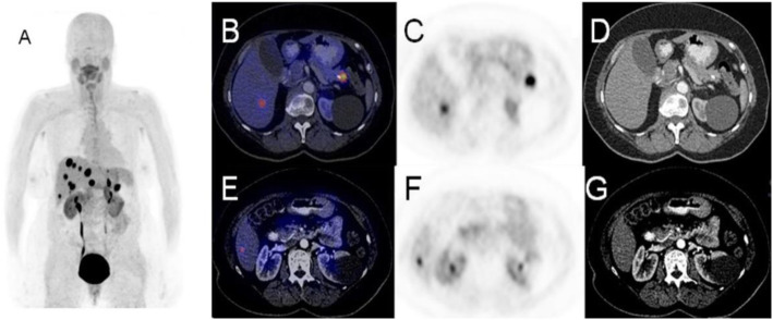 Fig. 45