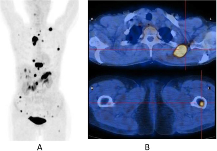 Fig. 43