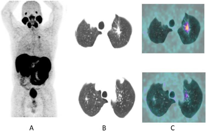 Fig. 37