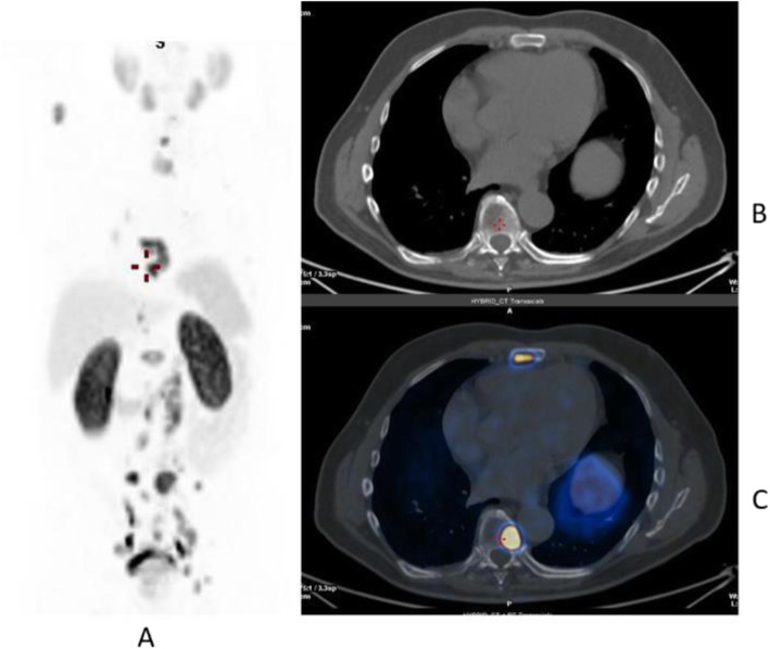 Fig. 26